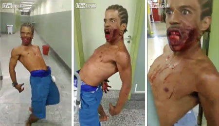 【衝撃映像】ブラジル・リオの病院で口を銃で撃たれた男がゾンビに!?の画像1