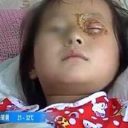 【チャイナボカン】今度は誕生日ケーキが爆発！　女児の角膜直撃で失明の危機に……