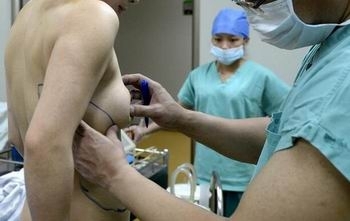 豊胸手術で可動式おっぱいに!? 偽乳が背中にお引っ越しの画像2