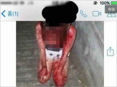 韓国の女子中学生が後輩を壮絶リンチ、血まみれに……　被害少女「2カ月前にも暴行されていた」　の画像1
