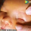 中国で“眼球のない赤ちゃん”が誕生！　深刻な環境汚染が原因で「100人に2人」先天性異常発症か