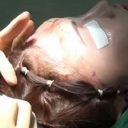 【閲覧注意】「ヤバすぎて泣いた」高須クリニックが投稿している衝撃・整形手術動画！