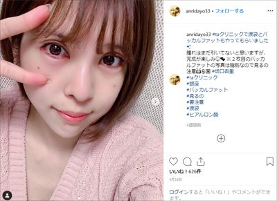 【校正待ち】坂口杏里、手のケガは嘘？　風俗の接客がおざなりな裏事情って……の画像1