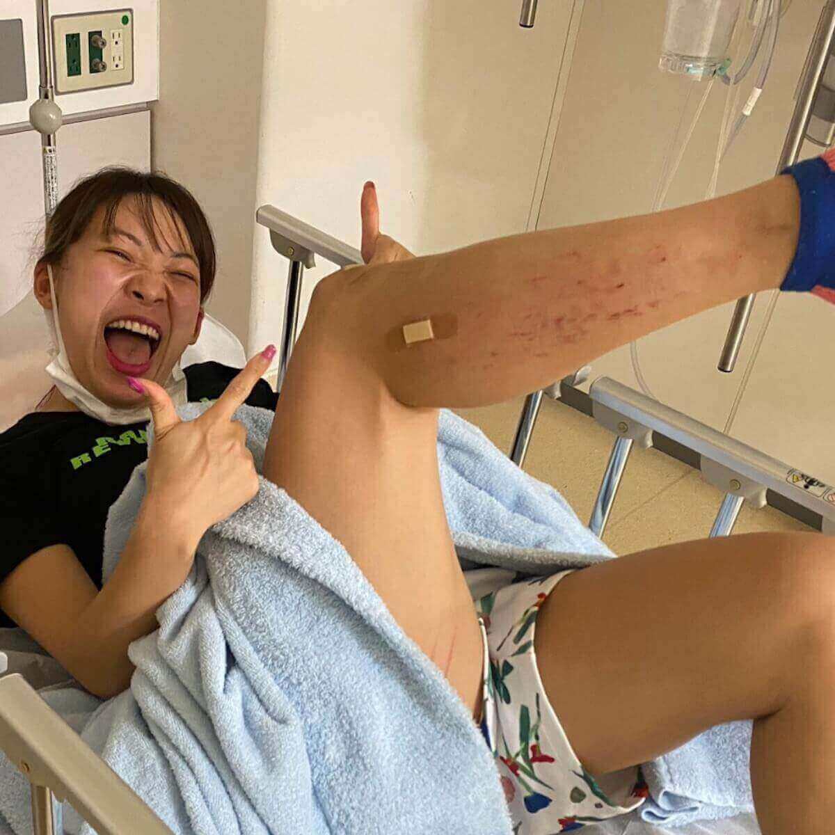 事故 フワ ちゃん