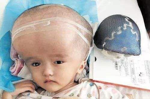 中国の乳児にまたしても健康被害が！　身体の巨大化や多毛症の原因とは？の画像3