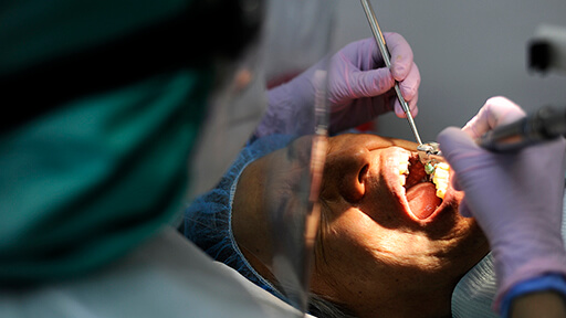 銀歯で金属アレルギーが発生 メカニズムを東北大研究Gが解明　の画像1